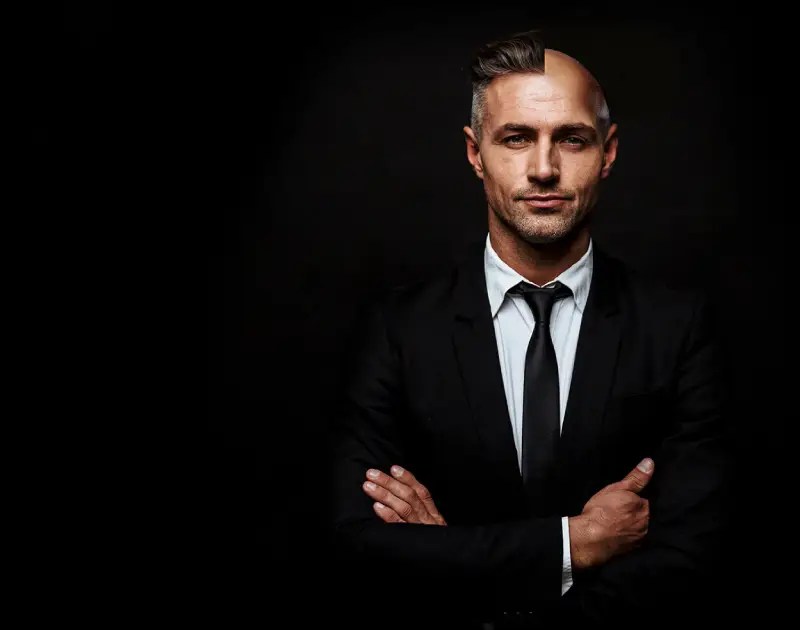 hair transplant in Istanbul