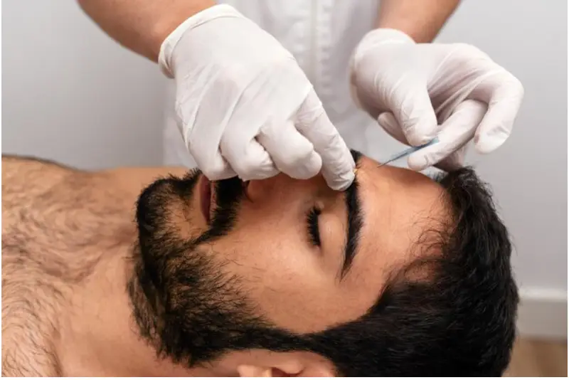 Eyebrow hair transplant in Istanbul