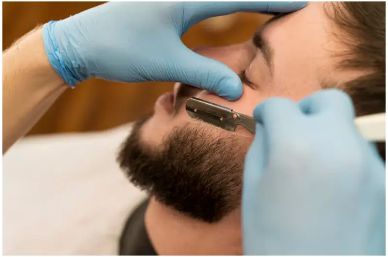 beard transplant in Istanbul